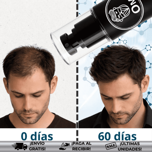 OmHair® | Tratamiento eficaz para caída del cabello ¡OFERTA 2x1!