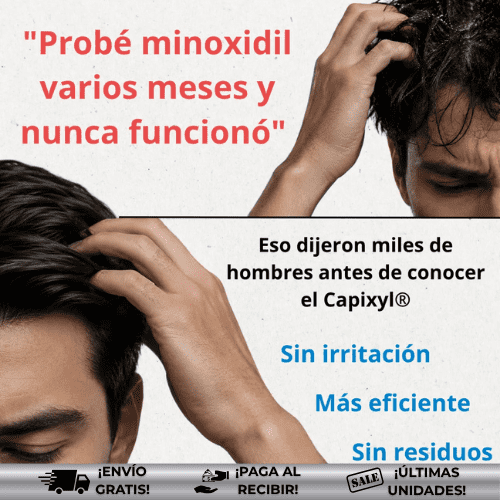 OmHair® | Tratamiento eficaz para caída del cabello ¡OFERTA 2x1!